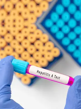 Private Hepatitis A Testing in London