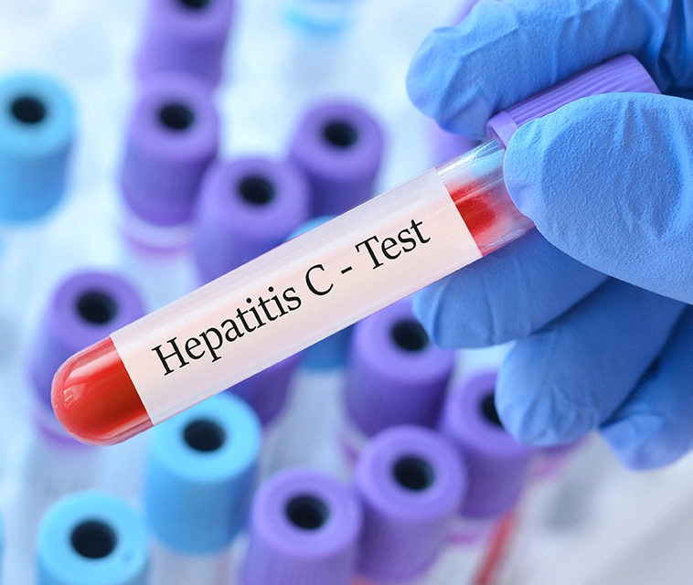 Why Should I Get Tested for Hepatitis C?