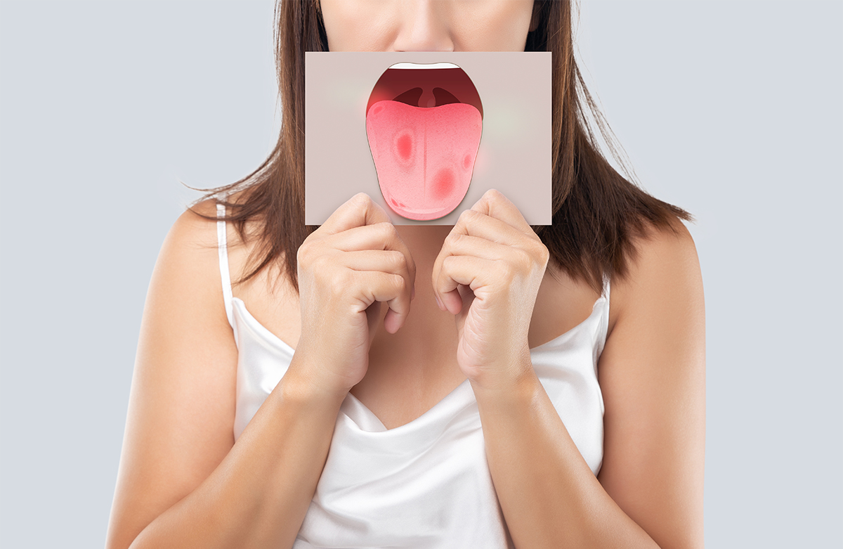 Oral Gonorrhoea: Risks, Symptoms, and Ways to Stay Protected